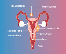 laparoscopic-surgery