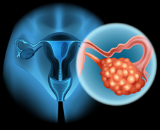 laparoscopic-surgery