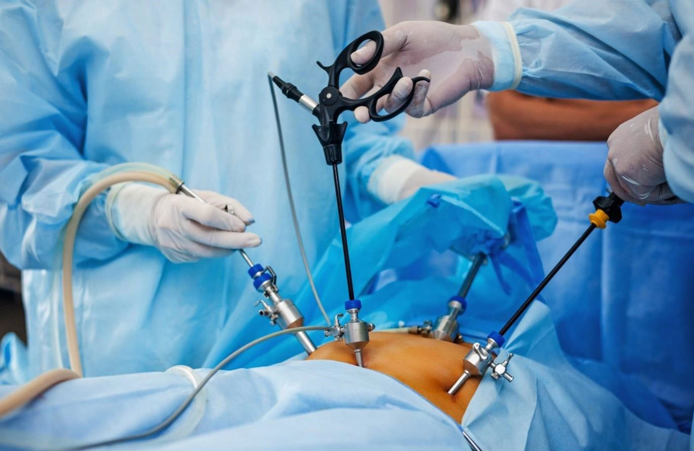 laparoscopic-surgery