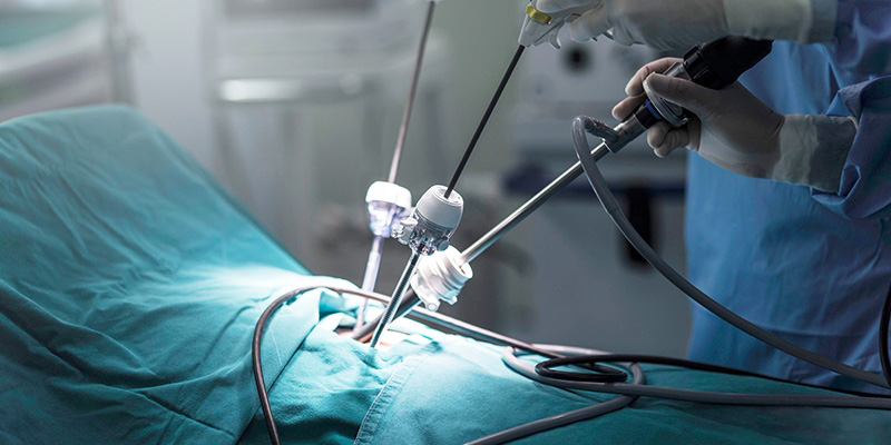 laparoscopic-cancer-surgery